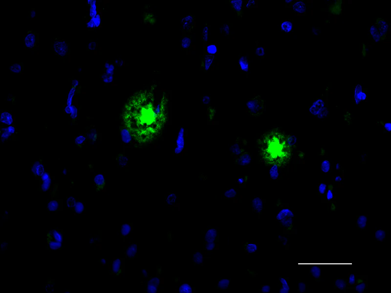 Alexa Fluor® 488 anti-β-Amyloid, aggregated