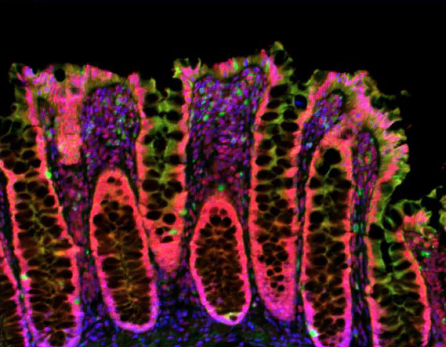 Alexa Fluor® 488 anti-Cytokeratin (pan reactive) - Image 2