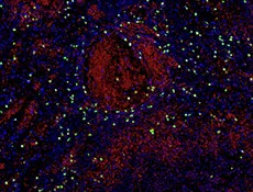 Alexa Fluor® 488 anti-human CD15 (SSEA-1) - Image 2