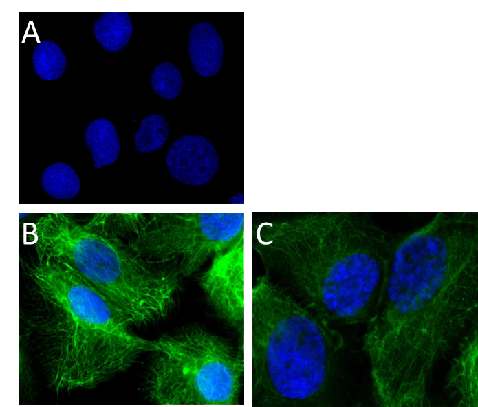 Alexa Fluor® 488 anti-human Cytokeratin 7
