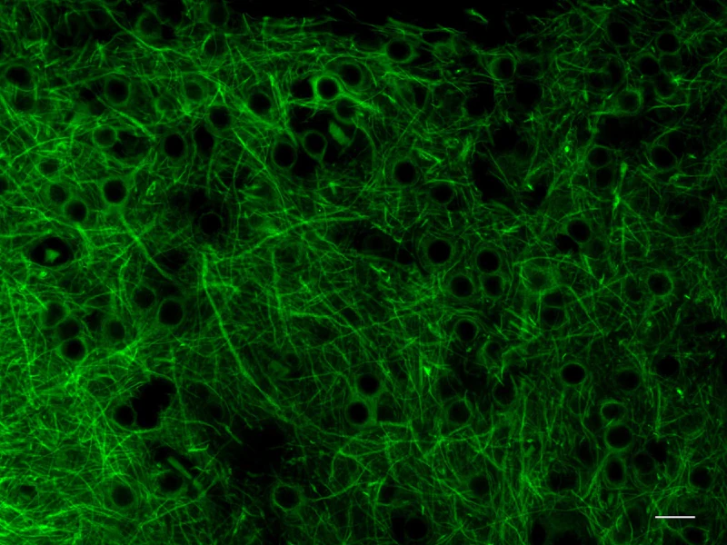 Alexa Fluor® 488 anti-MAP2 - Image 2