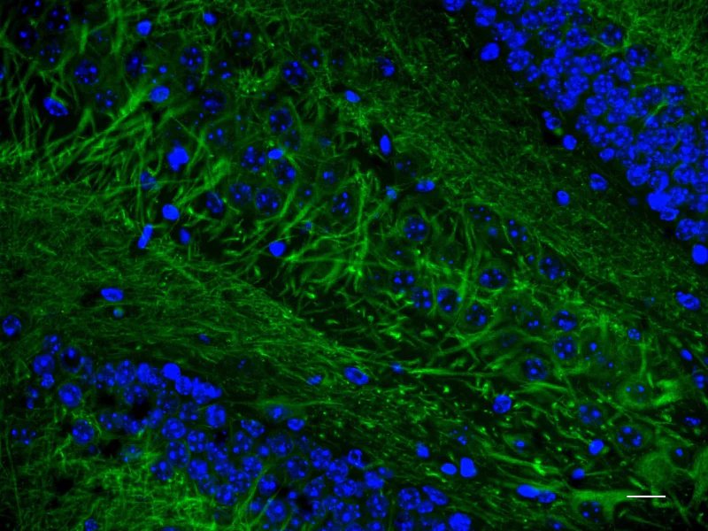 Alexa Fluor® 488 anti-MAP2 - Image 3