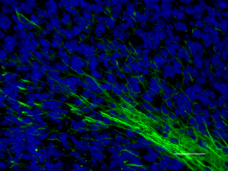 Alexa Fluor® 488 anti-Myelin Basic Protein