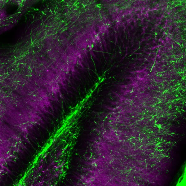 Alexa Fluor® 488 anti-Myelin Basic Protein - Image 4