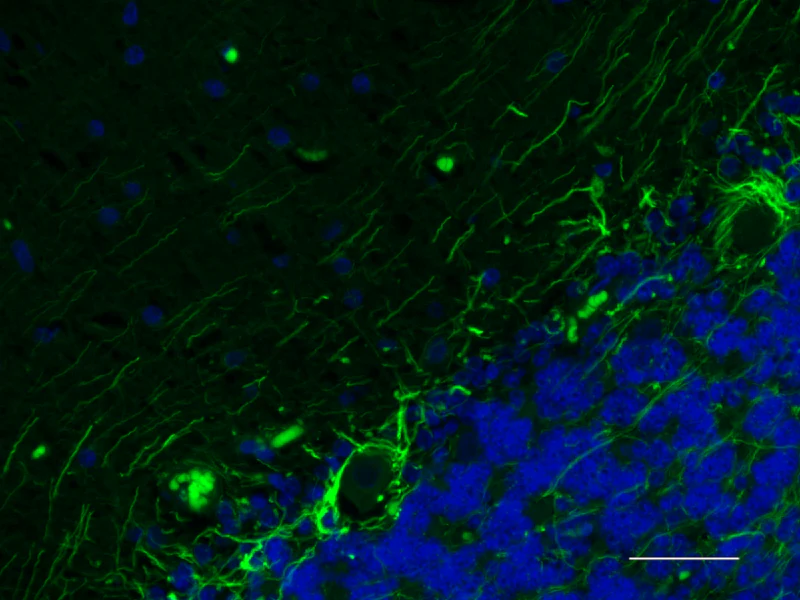 Alexa Fluor® 488 anti-NF H & M (NF-H/NF-M), Phosphorylated - Image 2