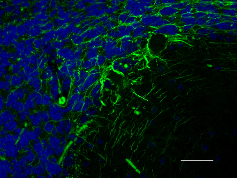 Alexa Fluor® 488 anti NF-H/NF-M, Hypophosphorylated