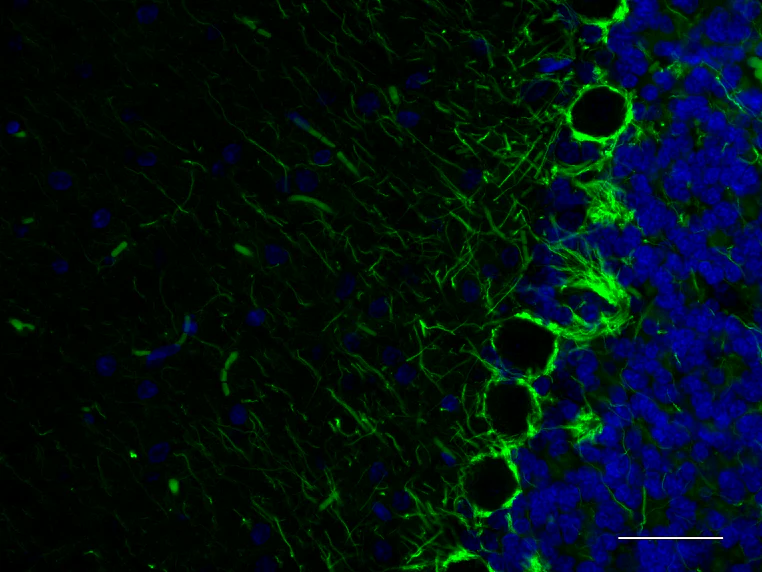 Alexa Fluor® 488 anti NF-H/NF-M, Hypophosphorylated - Image 2