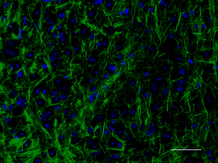 Alexa Fluor® 488 anti NF-H/NF-M, Hypophosphorylated - Image 3