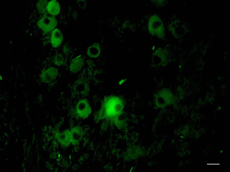 Alexa Fluor® 488 anti-NSE - Image 2