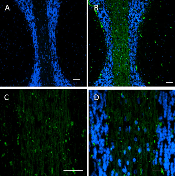 Alexa Fluor® 488 anti-Oligodendrocyte Marker O1