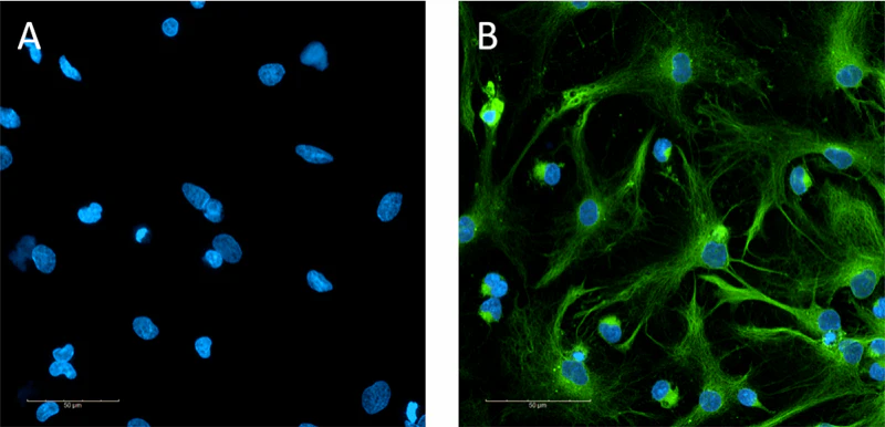 Alexa Fluor® 488 anti-Oligodendrocyte Marker O1 - Image 2