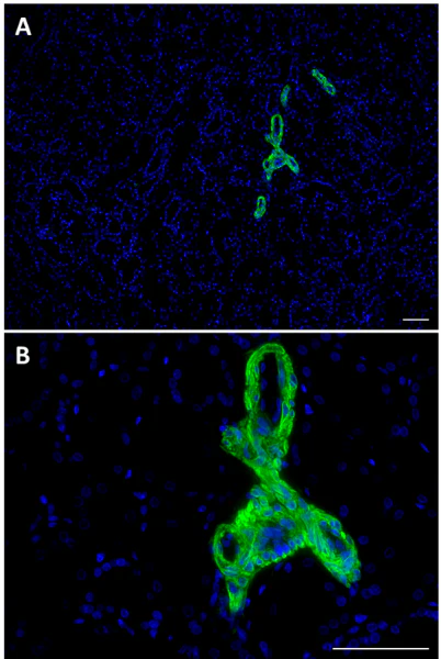 Alexa Fluor® 488 anti-α Smooth Muscle Actin