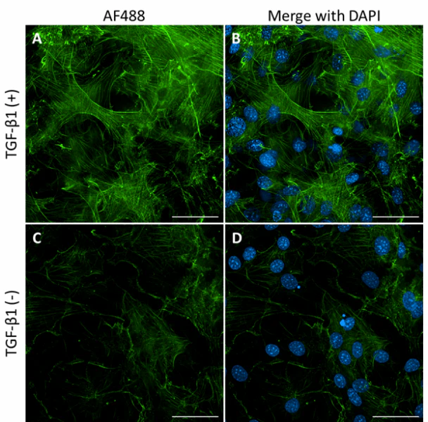 Alexa Fluor® 488 anti-α Smooth Muscle Actin - Image 2