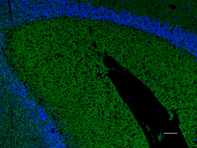 Alexa Fluor® 488 anti-Synapsin I/II/III
