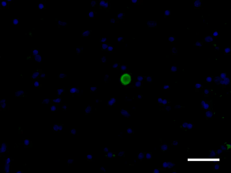 Alexa Fluor® 488 anti-α-Synuclein, aggregated