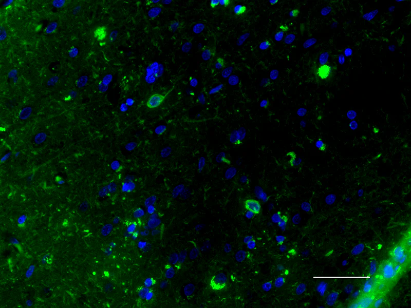Alexa Fluor® 488 anti-Tau Phospho (Thr181)