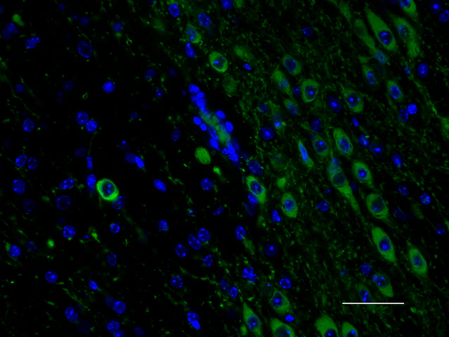 Alexa Fluor® 488 anti-Tyrosine Hydroxylase - Image 2