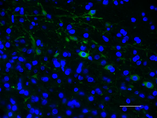 Alexa Fluor® 488 anti-Tyrosine Hydroxylase - Image 3