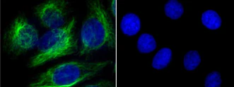 Alexa Fluor® 488 anti-Vimentin