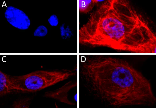 Alexa Fluor® 594 anti-Cytokeratin 17