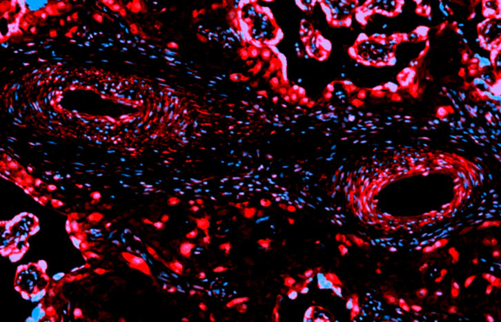 Alexa Fluor® 594 anti-human CD309 (VEGFR2)