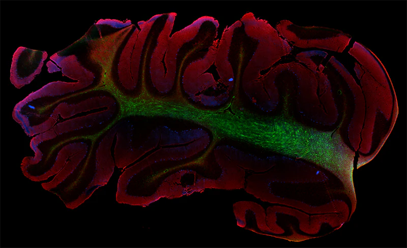 Alexa Fluor® 594 anti-human CD57 - Image 2