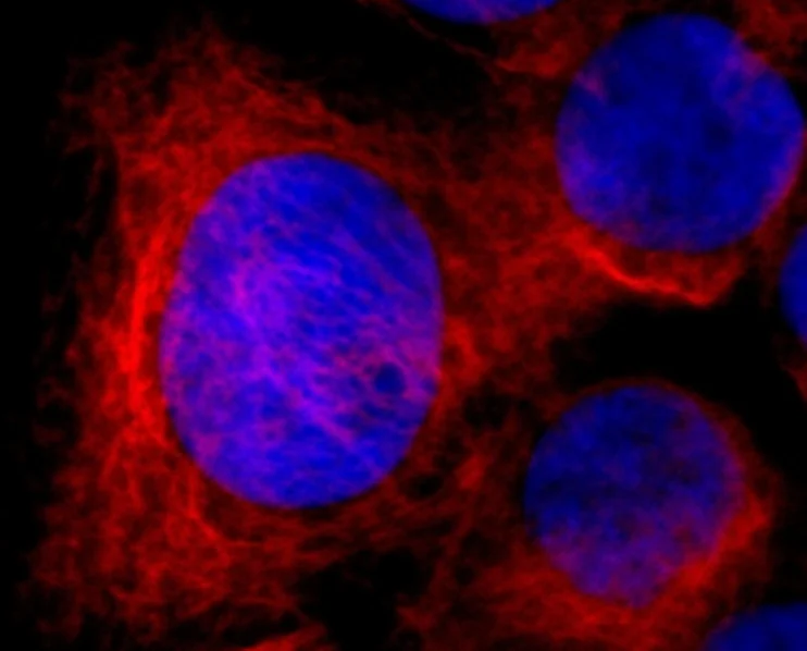 Alexa Fluor® 594 anti-human Cytokeratin 7