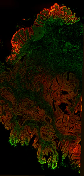 Alexa Fluor® 594 anti-human Galectin-4