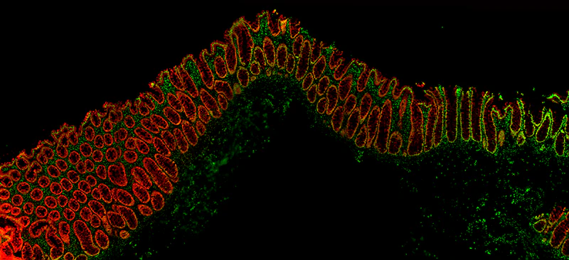 Alexa Fluor® 594 anti-human Galectin-4 - Image 2