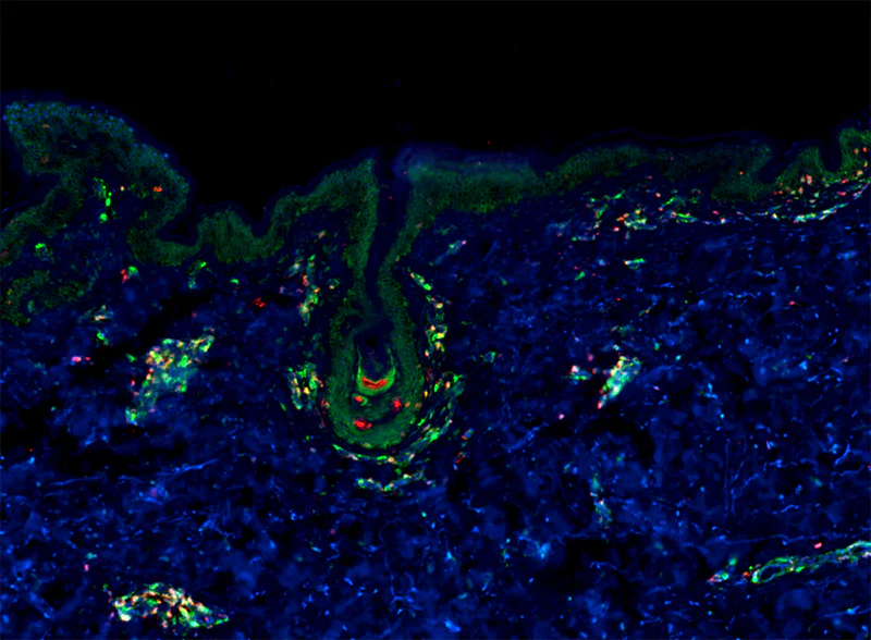 Alexa Fluor® 594 anti-human/mouse CLA - Image 2