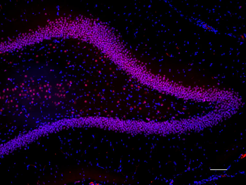 Alexa Fluor® 594 anti-MECP2 - Image 2