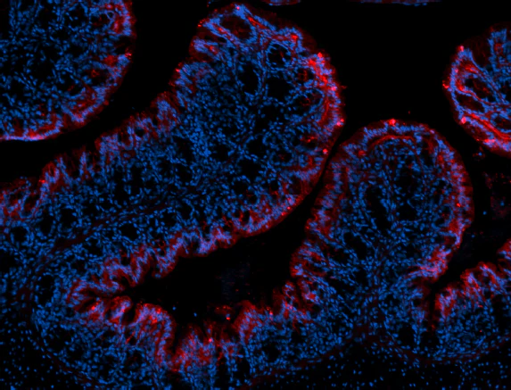 Alexa Fluor® 594 anti-mouse/human Mac-2 (Galectin-3)