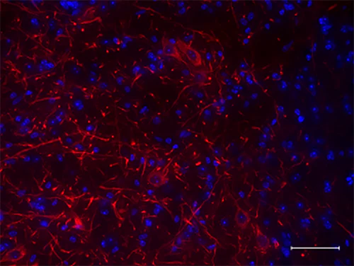 Alexa Fluor® 594 anti-Neurofilament H (NF-H), Nonphosphorylated - Image 2