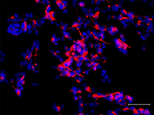 Alexa Fluor® 594 anti-Neurofilament H (NF-H), Nonphosphorylated - Image 3