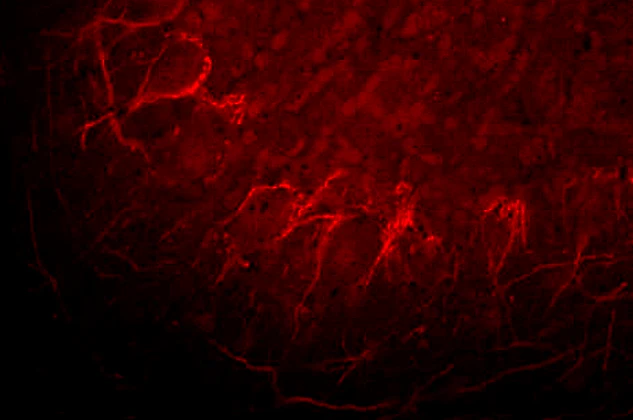 Alexa Fluor® 594 anti NF-H/NF-M, Hypophosphorylated