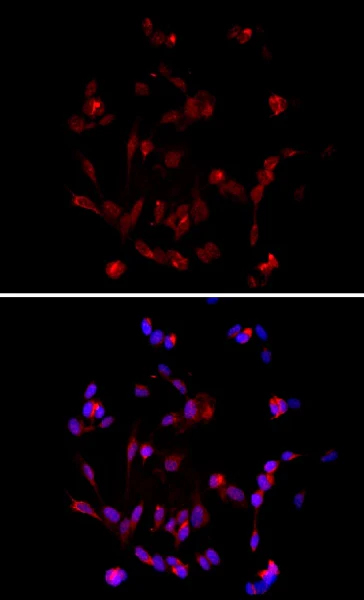 Alexa Fluor® 594 anti NF-H/NF-M, Hypophosphorylated - Image 2