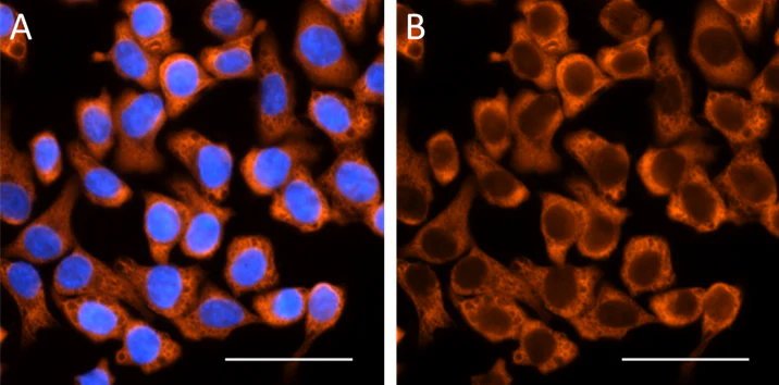 Alexa Fluor® 594 anti-rat IgG2b - Image 2