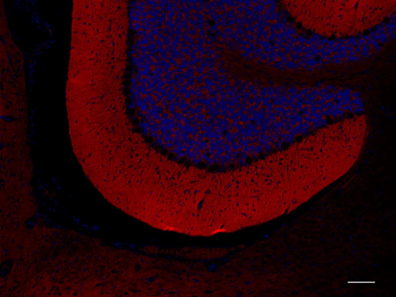 Alexa Fluor® 594 anti-SNAP-25 - Image 3