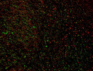 Alexa Fluor® 594 anti-SPI1 (PU.1) - Image 2