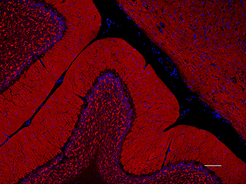 Alexa Fluor® 594 anti-Synapsin I/II/III - Image 2