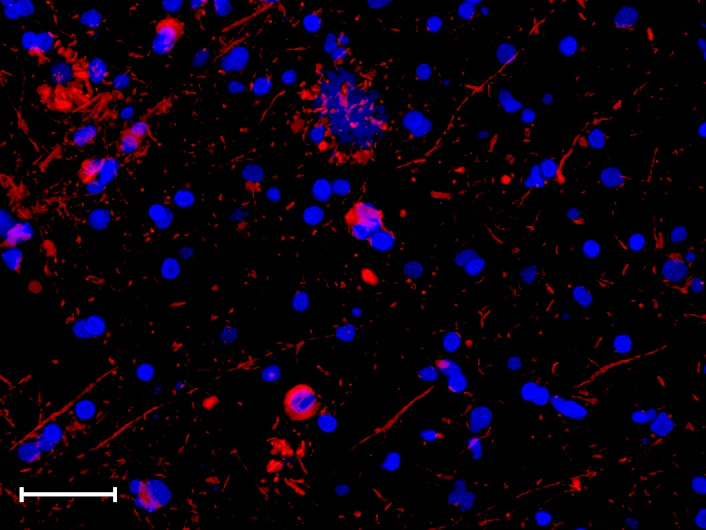 Alexa Fluor® 594 anti-Tau Phospho (Thr181)
