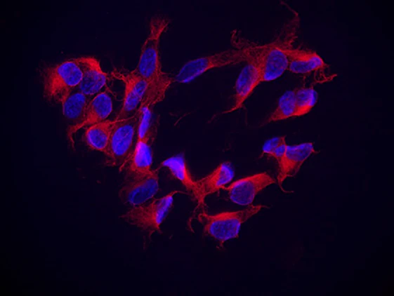 Alexa Fluor® 594 anti-Tubulin β 3 (TUBB3)