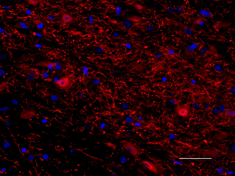 Alexa Fluor® 594 anti-Tyrosine Hydroxylase - Image 2