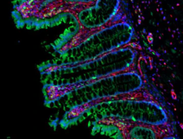 Alexa Fluor® 594 anti-Vimentin - Image 2
