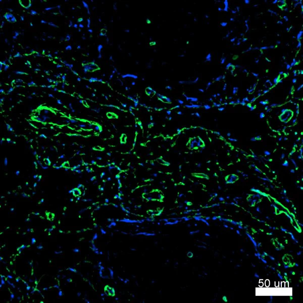 Alexa Fluor® 594 anti-Vimentin - Image 3