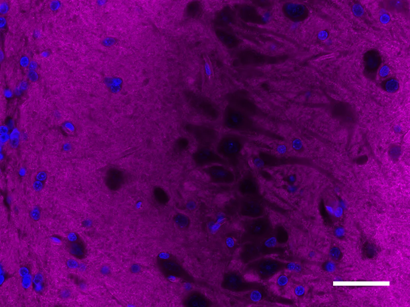 Alexa Fluor® 647 anti-Alpha-II Spectrin - Image 3