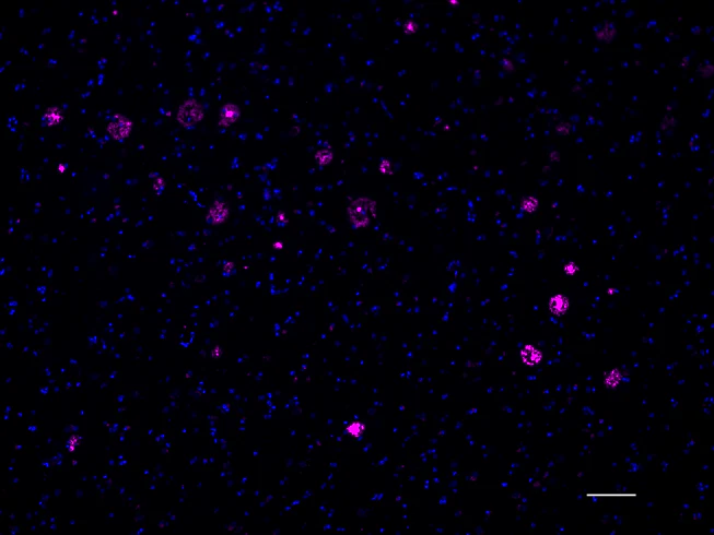 Alexa Fluor® 647 anti-β-Amyloid, 1-16