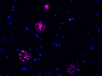 Alexa Fluor® 647 anti-β-Amyloid, 1-16 - Image 2