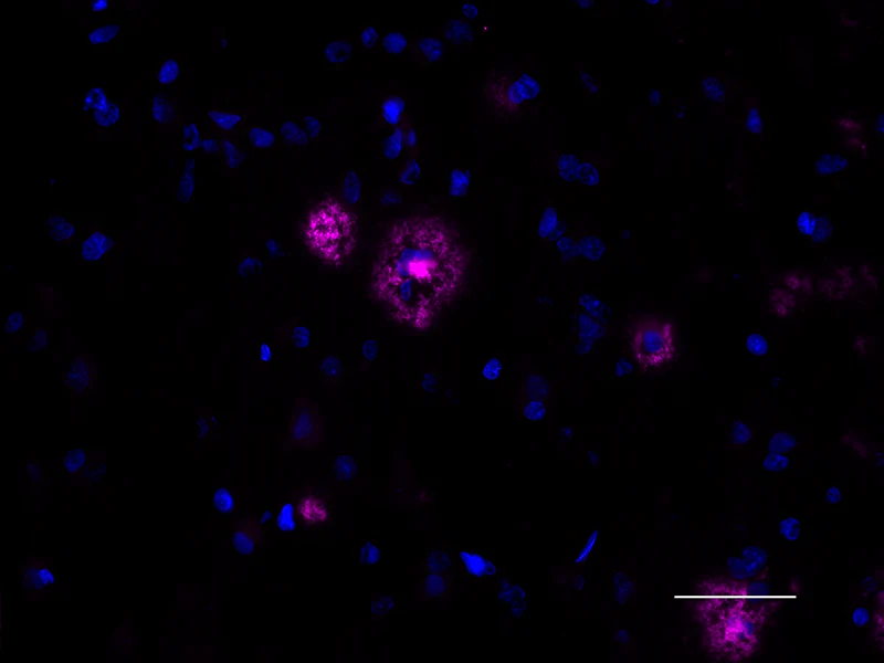 Alexa Fluor® 647 anti-β-Amyloid, aggregated