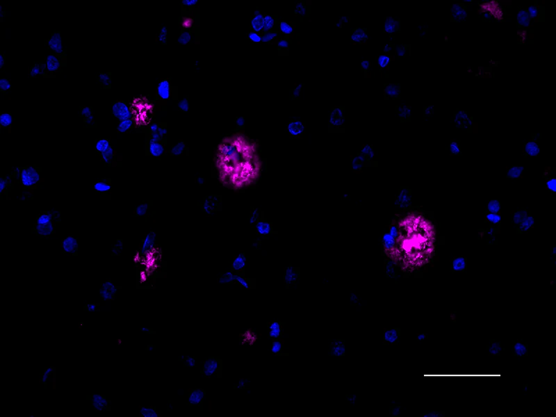 Alexa Fluor® 647 anti-β-Amyloid, aggregated - Image 2